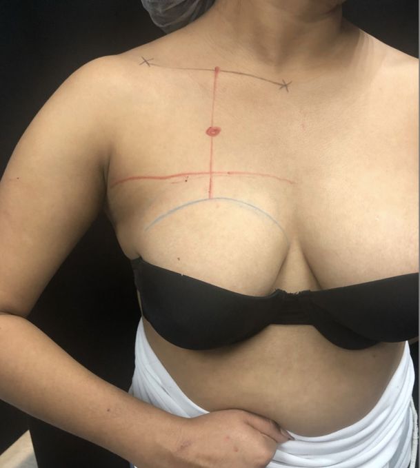female step 5