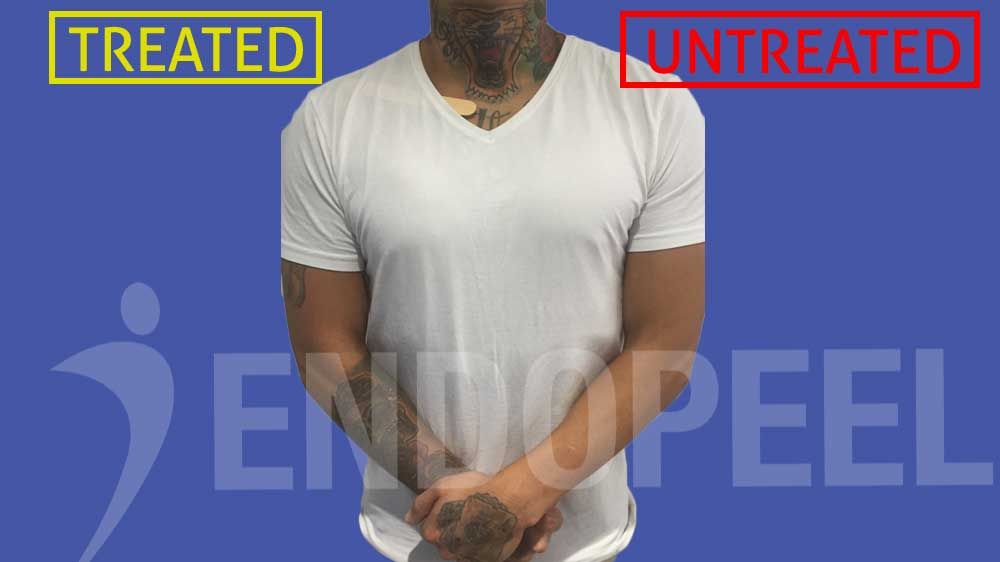 slide95