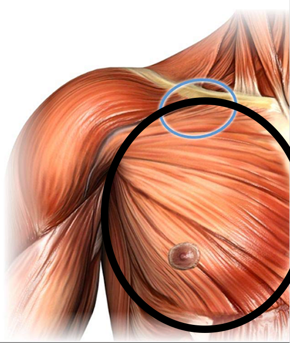 step1-pectoroplasty