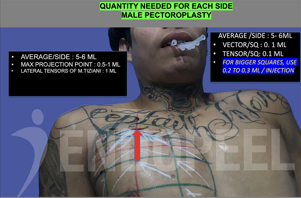 Step14- quantities to inject