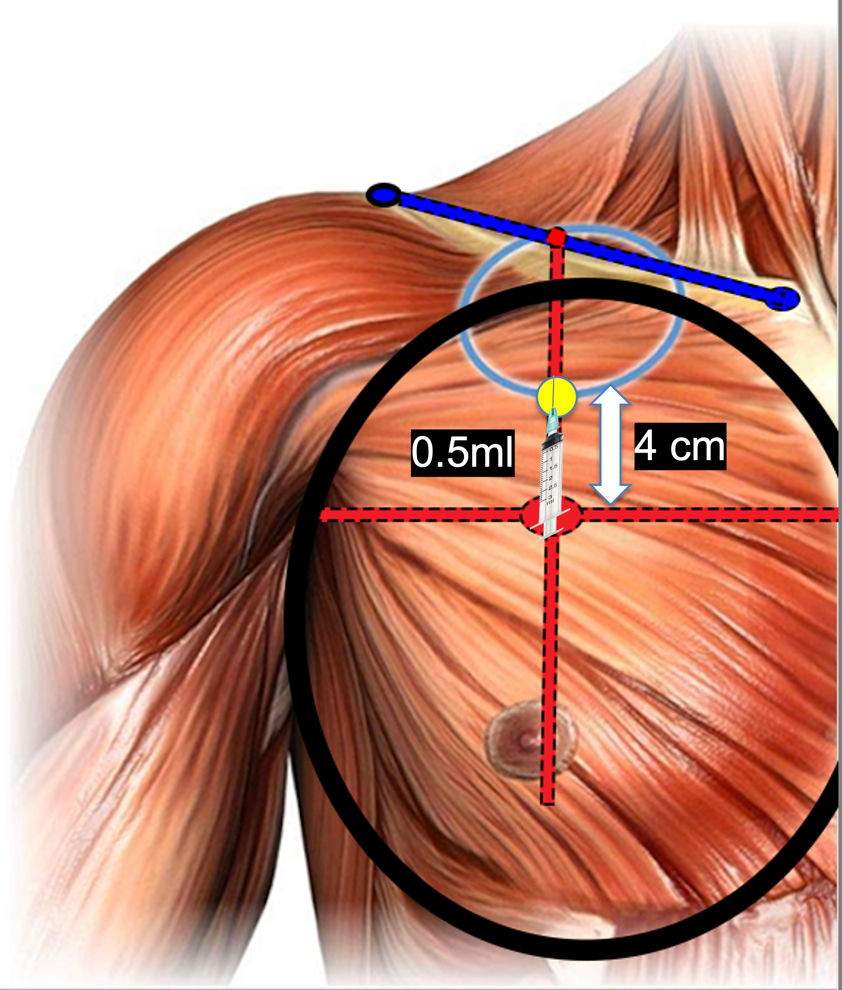 Step12- tensor of new point of maximum projection