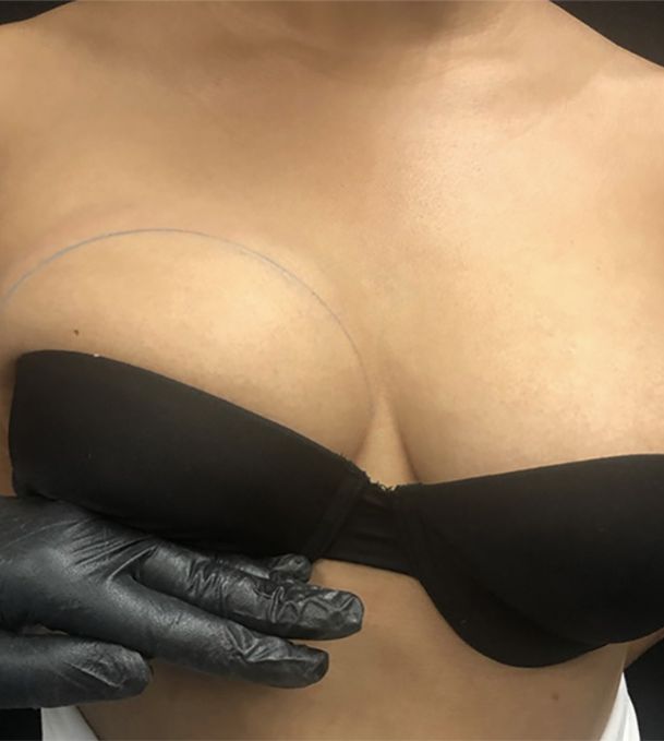 superior limit of female pectoral working area